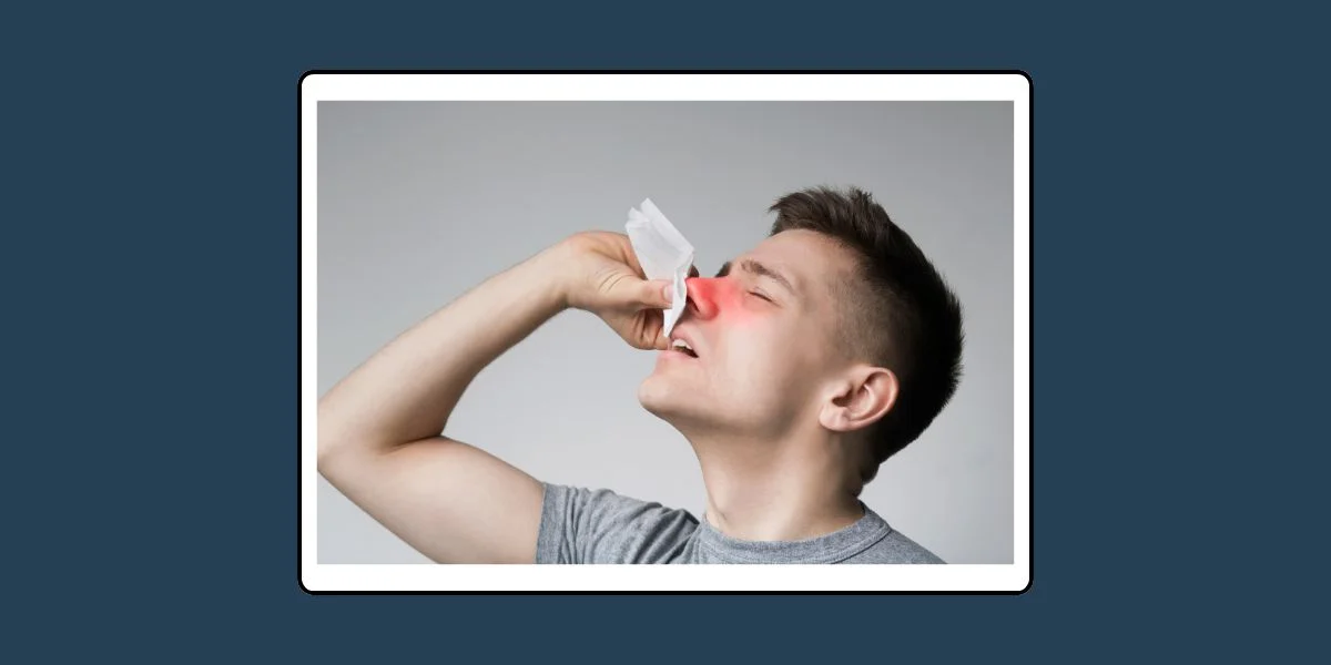 คำวินิจฉัย (ฟัตวา) จุฬาราชมนตรี ที่ 12/2557 เรื่อง ผู้ถือศีลอดมีอาการเลือดกำเดาไหล