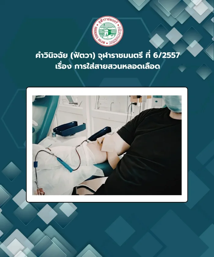 คำวินิจฉัย (ฟัตวา) จุฬาราชมนตรี ที่ 6/2557 เรื่อง การใส่สายสวนหลอดเลือด