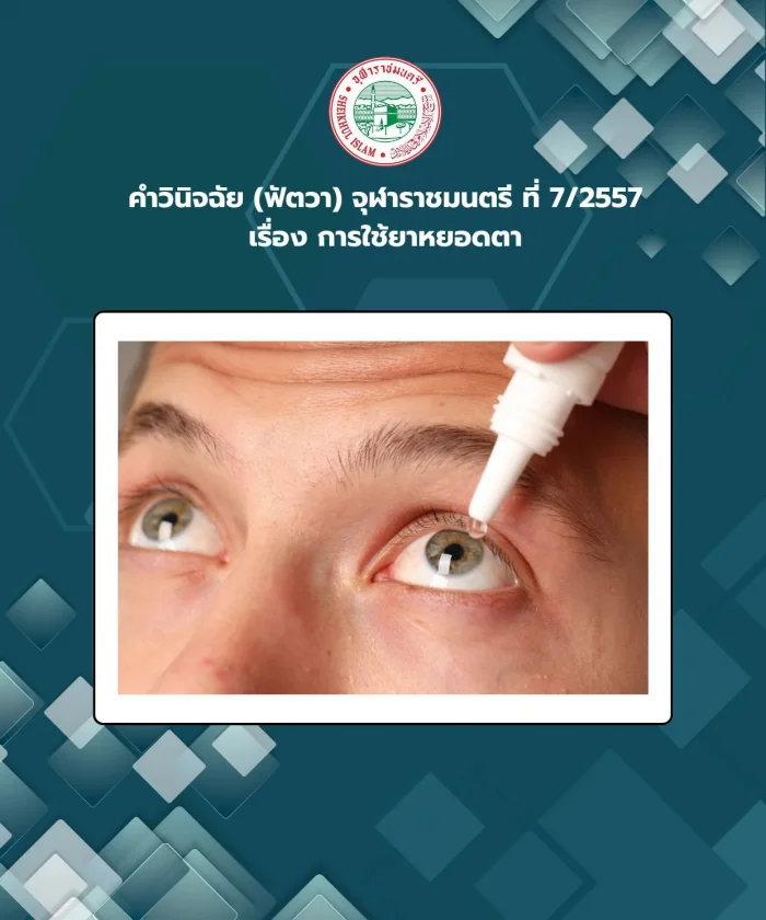 คำวินิจฉัย (ฟัตวา) จุฬาราชมนตรี ที่ 7/2557 เรื่อง การใช้ยาหยอดตา