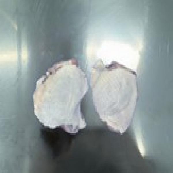 สะโพกไก่